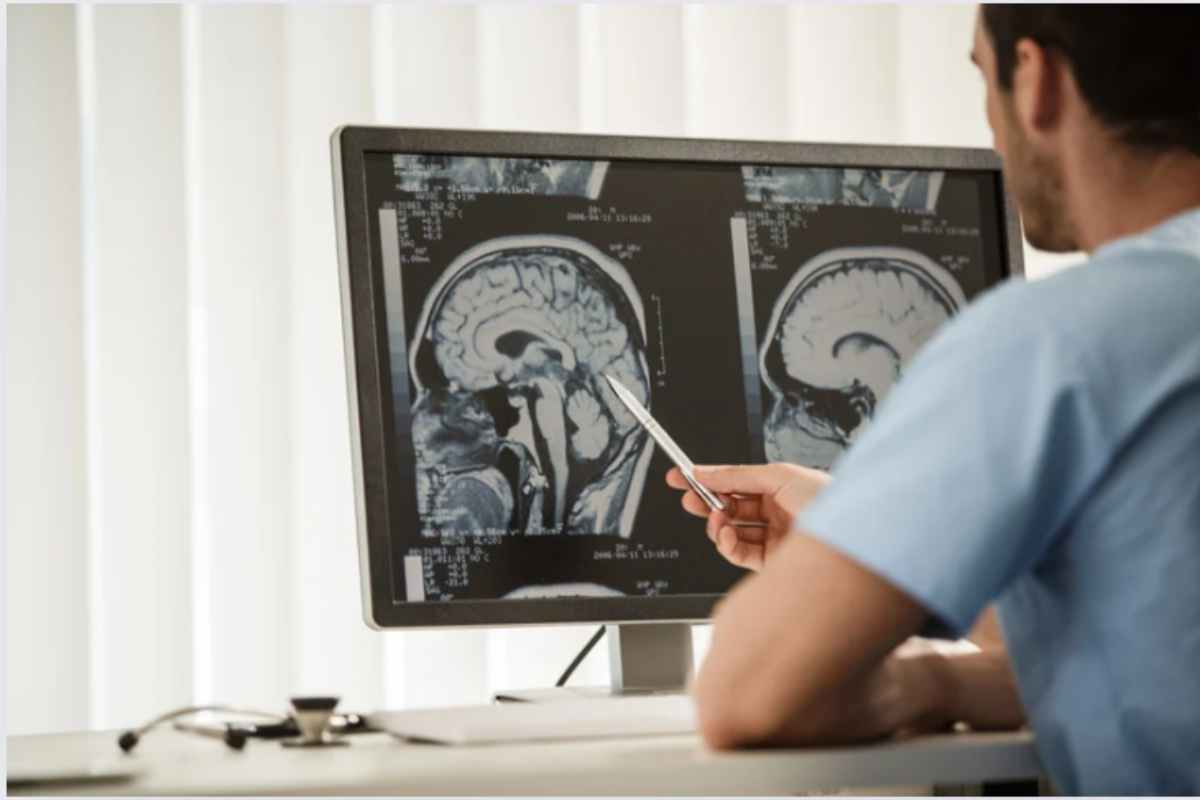 diagnosi tumore al cervello